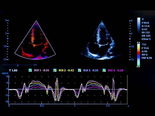 Ansicht Ultraschall Untersuchung